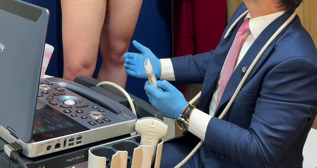 Aparelho de ultrassom portátil com o transdutor na mão enluvada do Dr. Igor Sincos, durante avaliação vascular